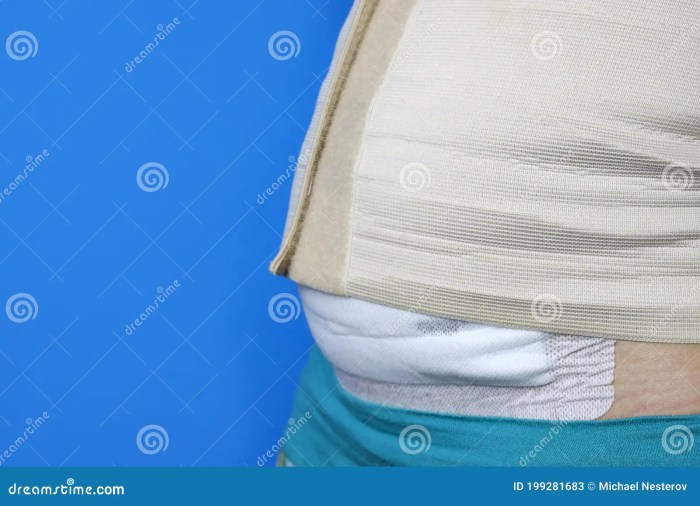 Motif 2-step c-section bandage system