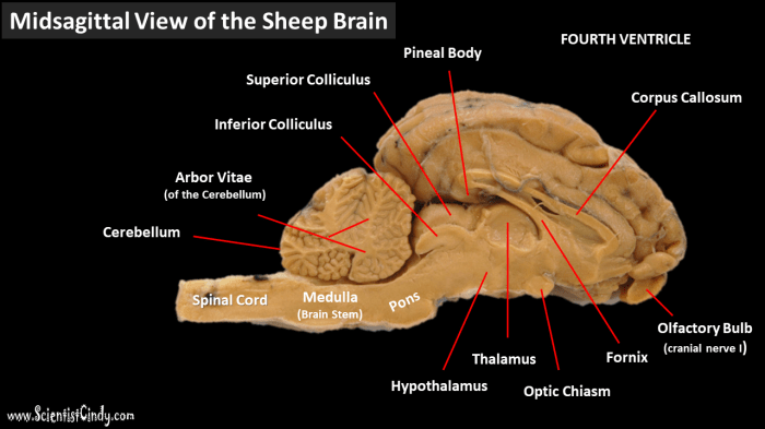 Brain sheep dissection guide lab biology biologycorner science human structures anatomy visit